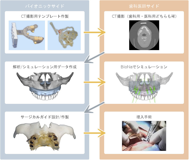 サージカルガイドの作製