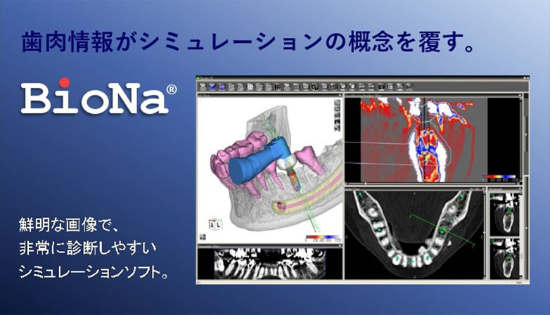 BioNaシステム